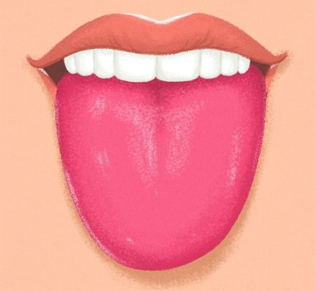 Эксфолиативный глоссит