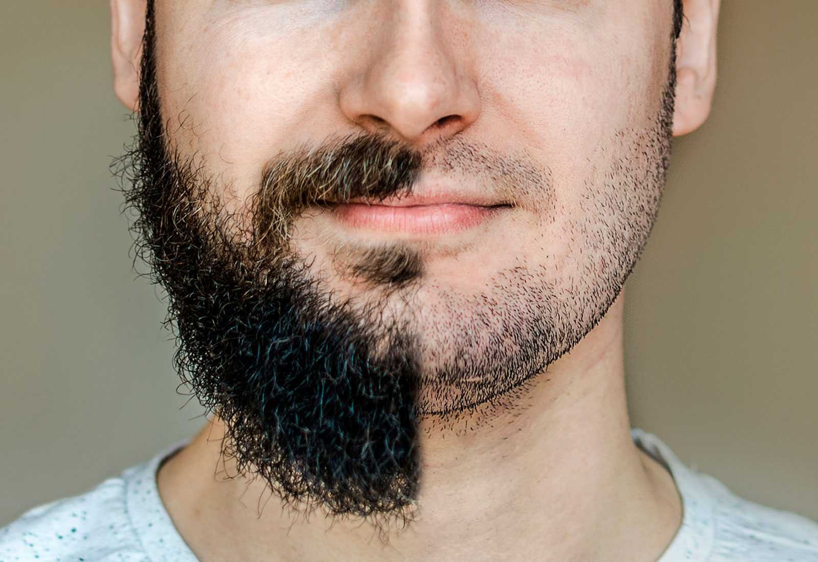 Отращивание бороды