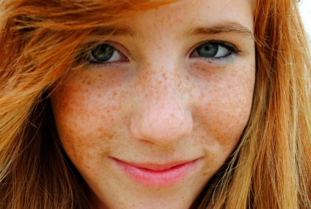 Лореаль веснушки