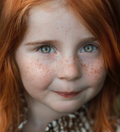 Riley Rasmussen Freckles