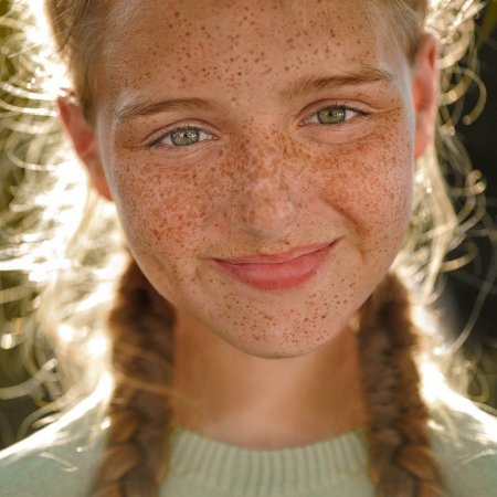 Веснушка Ахерн