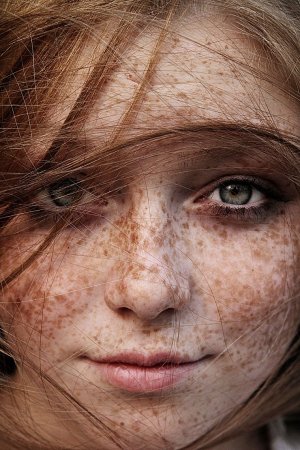 Селина Скиндер веснушки