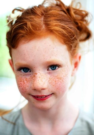 Freckles Эвелина Лашук