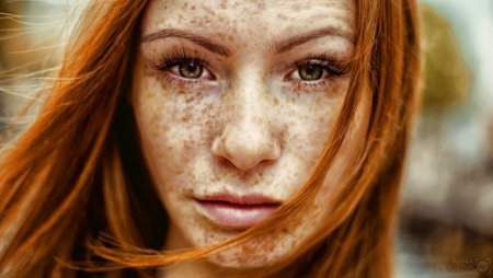 Селина Скиндер веснушки