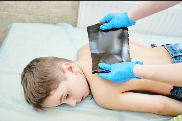 Теплолечение (озокеритолечение);