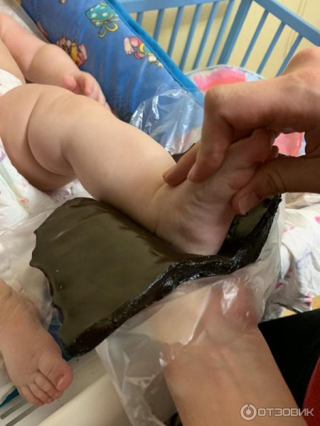 Теплолечение озокеритом