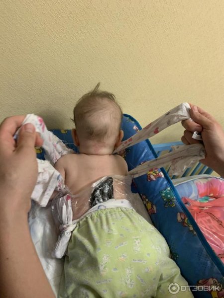 Парафинотерапия для шеи ребенку