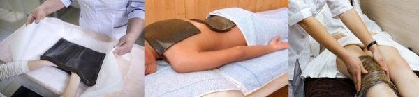 Парафино Озокеритотерапия