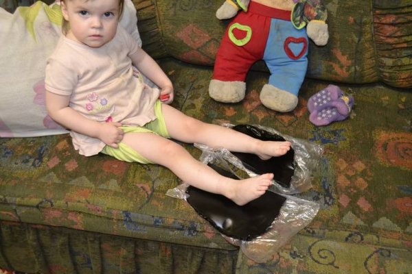 Парафино-озокеритовые аппликации