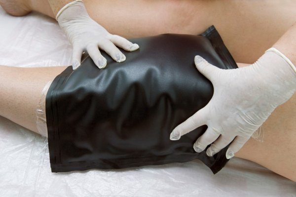 Теплолечение парафином и озокеритом