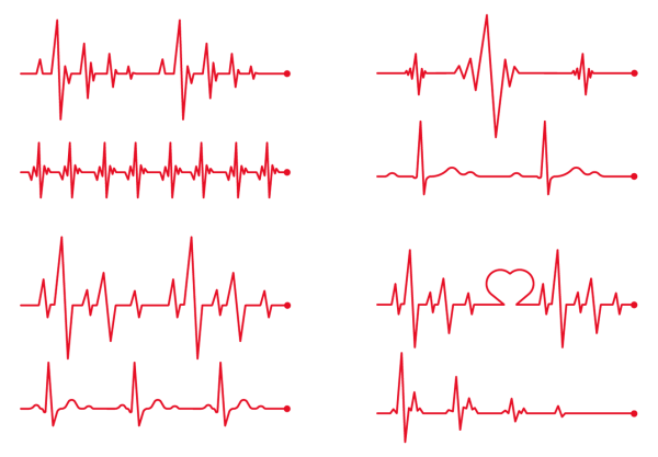 Кардиограмма сердца