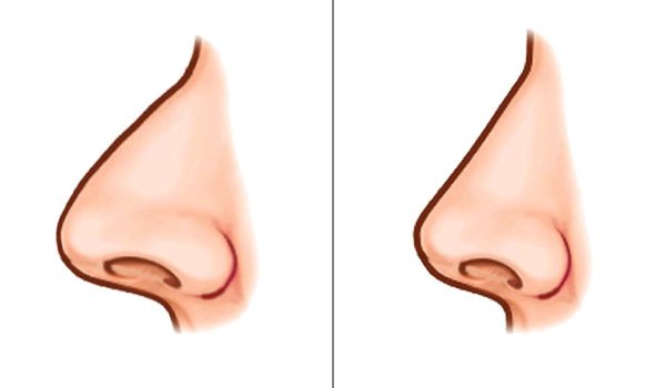 Нос мультяшный