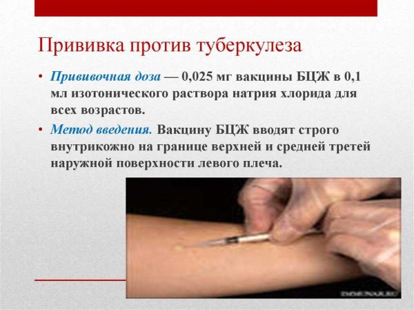 Прививки против туберкулеза проводятся в