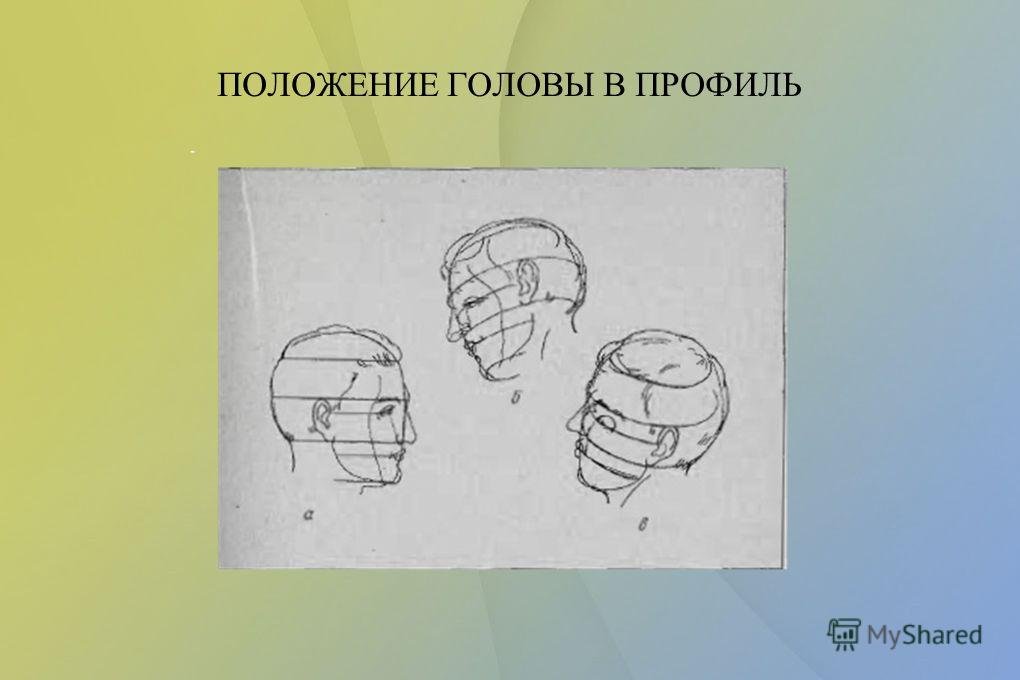 Тема лоб. Схема построения гипсовой головы Антиноя. Этапы рисования гипсовой головы. Рисунок гипсового слепка античной головы. Положение головы в профиль.