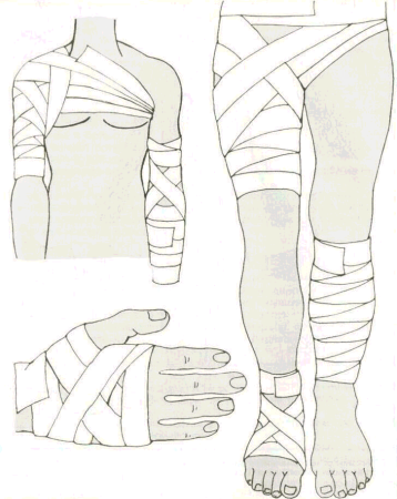 Аниме бинтование бинтование руки