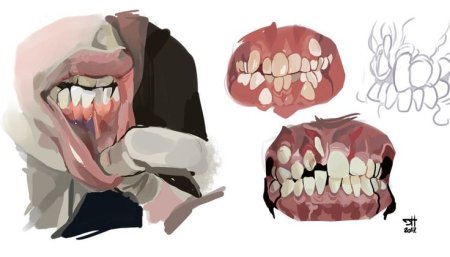 Зубы референсы