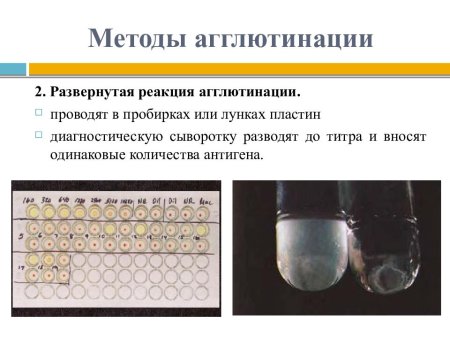 Развернутая реакция агглютинации Райта