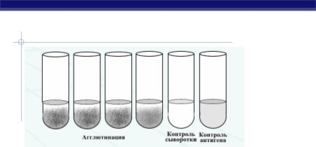Реакции агглютинации, непрямой гемагглютинации