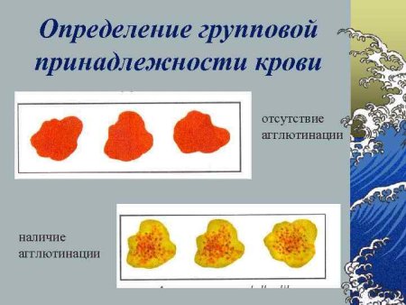 Реакция агглютинации крови группы схема