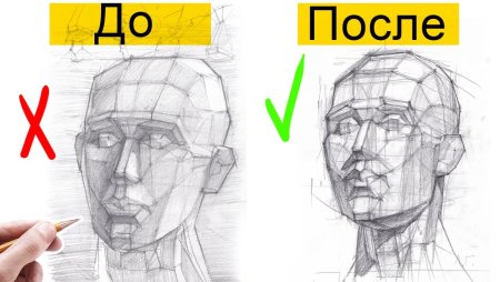 Обрубовка черепа по Баммесу гипс