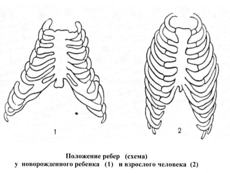 Окончатый перелом ребер