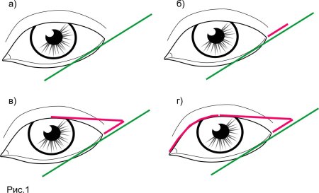 Схема нанесения стрелок
