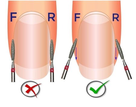 Схема аппаратного маникюра фрезой пламя