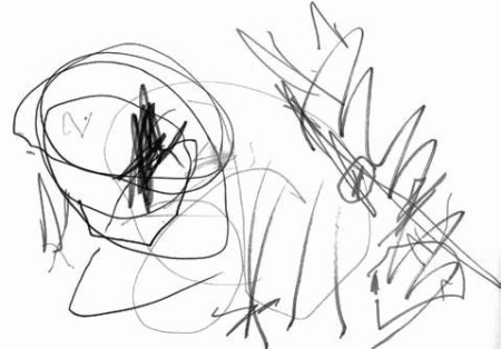 Стадия ритмических каракулей