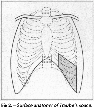 Синтез кофеина из ксантина