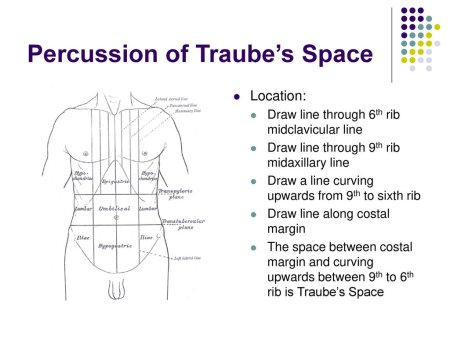 Синтез кофеина Траубе