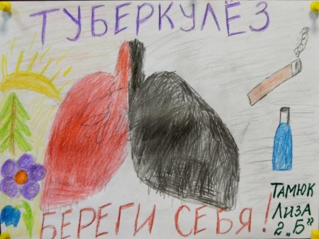 Мы против туберкулеза рисунки