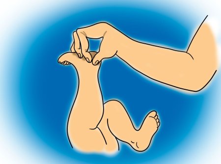 Ахиллесова пята древняя Греция