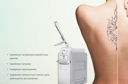 Лазерное удаление тату реклама