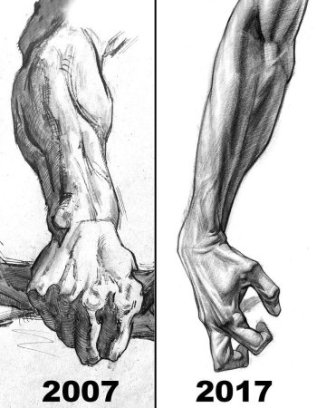 Предплечье пластическая анатомия