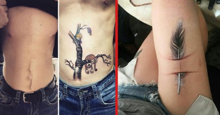 Художественное шрамирование