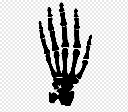 Скелет кисти