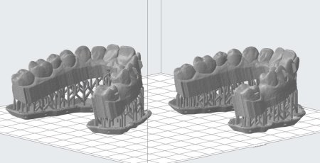3d сканер для элайнеров