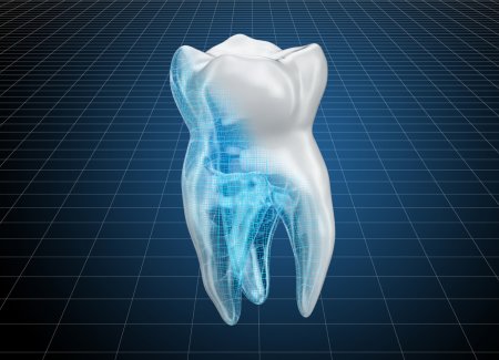 Зуб 3д сетка