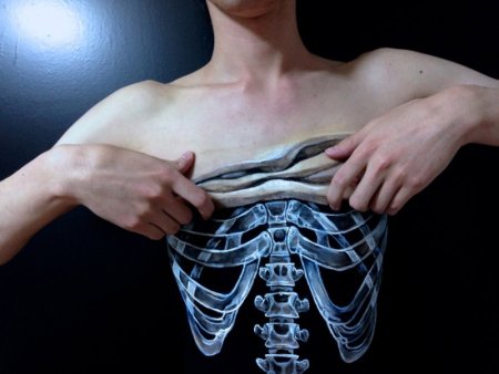 Открытая грудная клетка