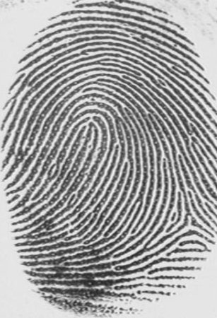 Петлевый капилярный узор