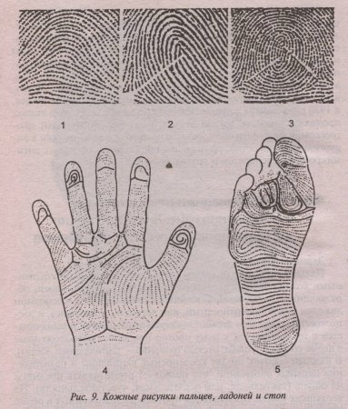 Типы папиллярных узоров пальцев