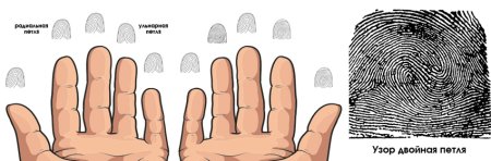 Радиальные петли дерматоглифика