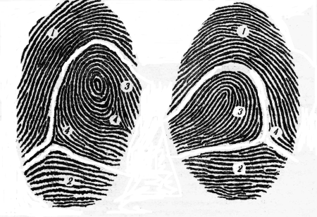 Зоны папиллярного узора пальца руки