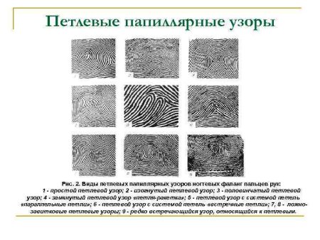 Петлевой папиллярный узор
