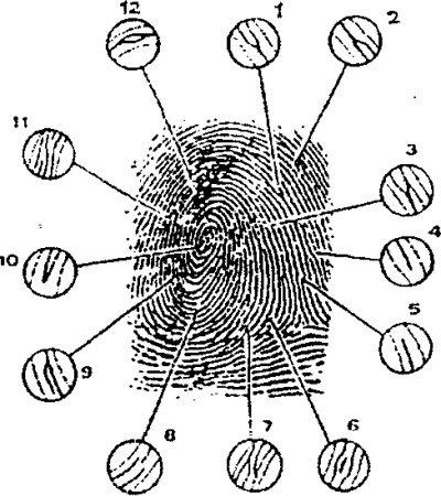 Дельта папиллярного узора пальца руки