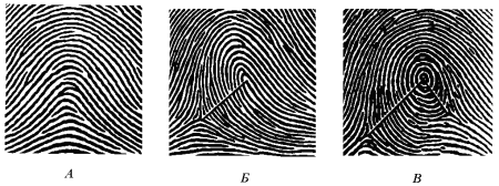Пальцевые узоры дерматоглифика