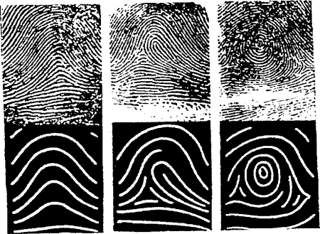 Петлевой Тип папиллярных узоров