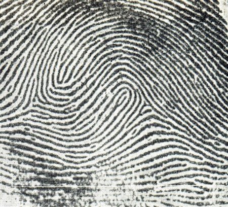 Петлевой папиллярный узор