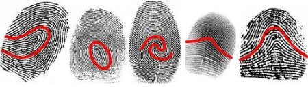 Двойная петля дерматоглифика