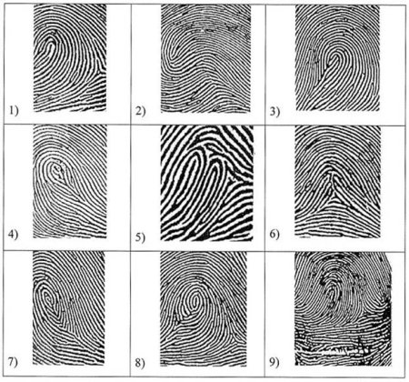 Петлевой Тип папиллярных узоров